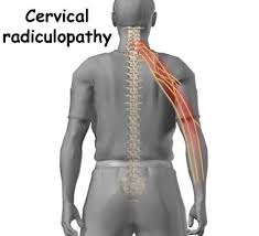 A dermatome is an area of skin which is chiefly supplied by a single spinal nerve. Pin Na Doske Medical Info