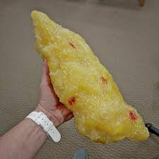 A Visualization Of 5 Pounds Of Body Fat Complete With Red Bits Of Vascularity R Mildlyinteresting