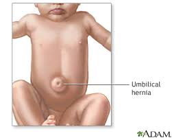 Image result for Umbilicus botryoides