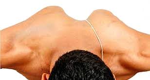 Image result for Winged Scapula