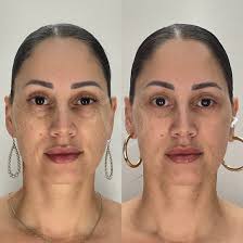 Vado Plastic Surgery added a new photo.