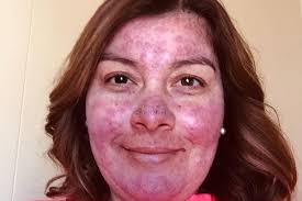 Fundraiser by Livier Perea : Cancer Treatment