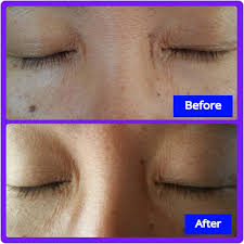 Notify me when this product is available: Rapidlash Review Mommomonthego Com