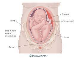 Fetal Presentation Before Birth Babycenter