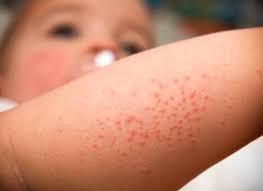 Total and new cases, deaths per day, mortality and recovery rates, current active cases singapore. Unduh 6400 Koleksi Gambar Flu Singapura Pixabay Pro