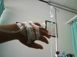 Jarum infus dapat terlepas jika selang infus tertarik. Gambar Orang Lagi Di Infus