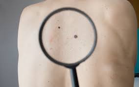 Here, a dermatologist shares more common signs of skin cancer to the swatch may be itchy and peel, and so it could seem an awful lot like dry skin. Can Babies Get Skin Cancer Can Pets Get Skin Cancer Petcoach It Happens Once Unrepaired Deoxyribonucleic Acid Harm To Skin These Dry Scaly Patches Or Spots Are Precancerous Growths