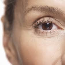 Shadows, flashes of light, or wiggly lines in your vision. Adult Strabismus Fact Sheets Yale Medicine
