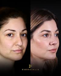 Am 23. Mai bin ich in Salzburg (Österreich)! 🇦🇹 Ich freue mich darauf,  Sie persönlich in der Klinik von Dr. Fatma Gürel zu treffen. Haben Sie  Fragen rund um Plastische Chirurgie? Jetzt