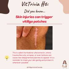 Image result for Skin Trauma