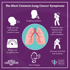 The symptoms of lung cancer range, like a chronic cough, can be easy to ignore or dismiss, but doing so can delay vital treatment. Taking A Breath To Tackle New Zealand S Biggest Cancer Killer Stories Cancer Research Trust Nz