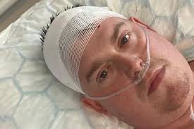 Dad, 35, with stage four brain cancer shares four terrifying symptoms he  noticed