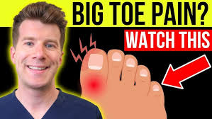 Image result for gout symptoms toe