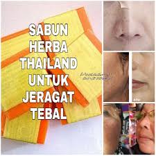 Cara menghilangkan jerawat dan bekasnya. Sabun Herba Untuk Hilangkan Jeragat Shopee Malaysia