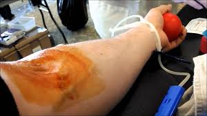 Maybe you would like to learn more about one of these? Donating Blood Youtube