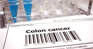 Late stage colon cancer symptoms in men and women. Actor S Death From Colorectal Cancer A Wake Up Call For Young Adults Ctca