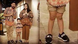 128 di bidang pertanian dikenal adanya suatu kelompok bakteri yang mampu ber simbiosis dengan akar tanaman atau hidup bebas di tanah untuk membantu penyuburan tanah. Bentuk Kaki Anak Raffi Ahmad Gigi Diduga Tak Normal Sebab Kaki X Dan Cara Atasinya