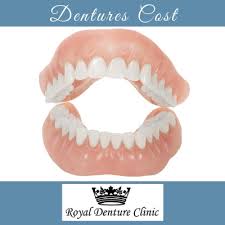 How much do dentures cost. How Much Does A Full Set Of Dentures Cost In Canada Royal Denture Clinic