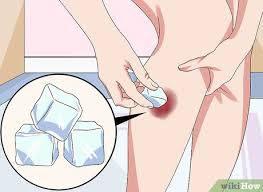 To make bruise marks go away fast, try the following natural home remedies and treatments. How To Heal A Bruise 9 Steps With Pictures Wikihow