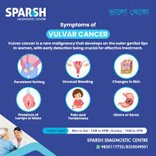 Image result for Vulvar Cancer