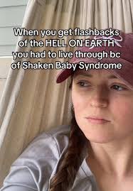 Shaken Baby Syndrome Demonstrated