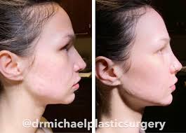 A heartfelt thank you to our wonderful client for this glowing 5-star  review! Renee, our fantastic PA, goes above and beyond to exceed  expectations. Your kind words truly inspire us. We appreciate