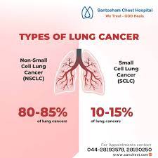 Santosham Chest Hospital - "Lung cancer can occur in 2 different forms based on the size of cancer cells. Causes and treatment also vary for these two. 1. Small cell lung cancer