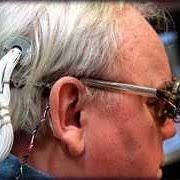 Future analog and digital techniques. Pdf From Cochlear Implants To Brain Computer Interfaces