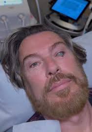 What happened to Stacey's face? That blotch