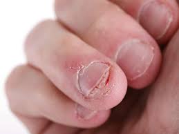 nail abnormalities causes symptoms and pictures