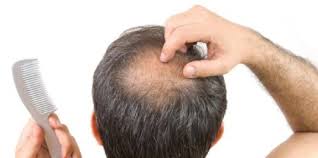Sebenarnya, ada banyak cara yang bisa dilakukan untuk mengatasi rambut mengembang yang sering membuat banyak orang kesal. 10 Makanan Untuk Rambut Sihat