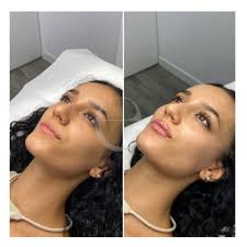 Medicina Estética Eres