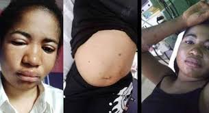 Prior to becoming a comedienne, ada jesus worked as a housekeeper to a retired pilot where she was paid n30,000. Revealed What Caused Ada Jesus Death Naija360 Ng