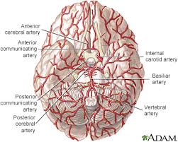 Cerebral Amyloid Angiopathy Information Mount Sinai New York