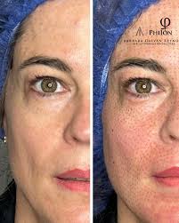 Barbara Galvan Facial Artist (@barbaragalvanfacialartist) • Instagram  photos and videos