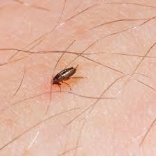 Image result for flea bite