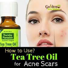 Pin On Essential Oils