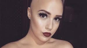 Treatment of severe alopecia areata with intralesional steroid injections. Woman With Alopecia Shares Inspiring Post About Feeling Beautiful Again Huffpost Uk Life
