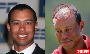 After decades of red wine, no exercise and 15 cigarettes a day, these are  the super-easy lifestyle tweaks that gave me a scientifically proven  biological age of 20