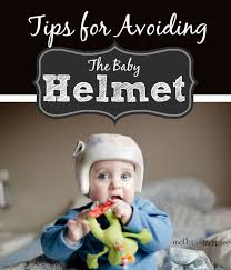 Plagiocephaly Tips For Avoiding The Baby Helmet Baby Helmet Baby Baby Head