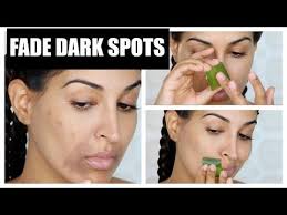 Pin On Facial Spots Upper Lip