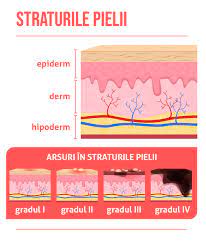 Stratul de gel poate fi protejat cu o compresa acoperita de un strat subtire de unguent de. Arsuri È™i OpÄƒriri Medic Chat