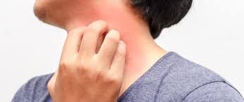 بعض التهابات الحوض تسبب حكة المهبل. Ø­ÙØ© Ø§ÙØ¬ÙØ¯ Ø§ÙØ§Ø³Ø¨Ø§Ø¨ Ø§ÙØ¹Ø§Ø¨Ø±Ø© ÙØ§ÙØ®Ø·ÙØ±Ø© ÙÙØ¨ Ø·Ø¨