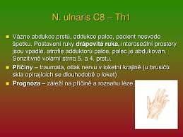 Prstu bude zachována díky inervační výjimce m. Ppt Cislo Projektu Cz 1 07 1 5 00 34 0188 Nazev Projektu Moderni Skola Powerpoint Presentation Id 4456544