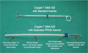 Pocius, iuds are an increasingly preferred method of birth control for women of all ages. Study Finds Benefits Of Device For Inserting Iuds Shortly After Birth News Center Stanford Medicine