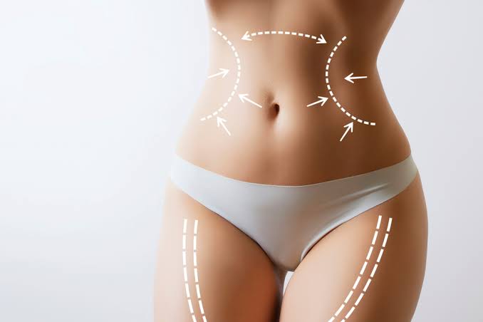 AURAE MD's Innovative and Effective Methods of Body Contouring