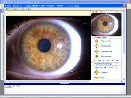 iridology software it is based on bernard jensens