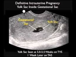 Pin On Ultrasound
