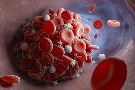 It can harm part of the lung due to restricted blood flow, reduce oxygen levels in the blood. Dangerous Blood Clots Increasingly Found In Covid 19 Patients Daily Sabah