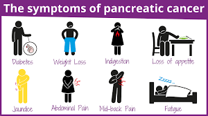 What causes pancreatic cancer, what is the survival rate for pancreatic cancer, and how is it treated? The Symptoms Of Pancreatic Cancer 1 Pancreatic Cancer Action